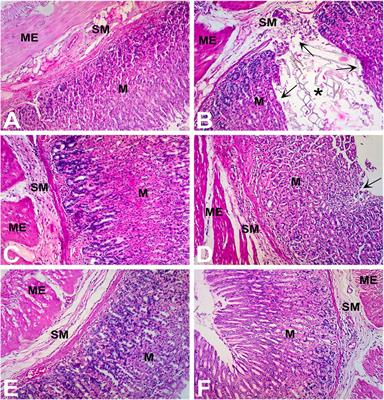 Corrigendum: GC-MS analysis and gastroprotective evaluations of crude extracts, isolated saponins, and essential oil from polygonum hydropiper L.